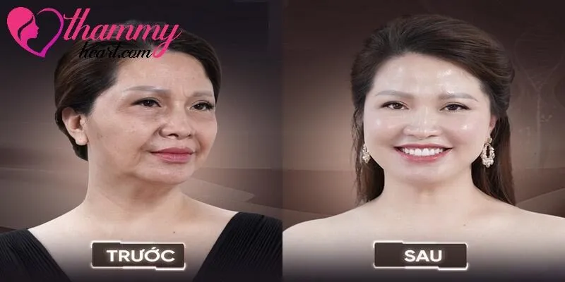 Hình ảnh trước và sau khi thực hiện dịch vụ trẻ hóa làn da