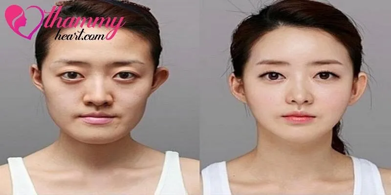 Thẩm Mỹ Heart cam kết chất lượng dịch vụ làm đẹp đảm bảo chất lượng cao