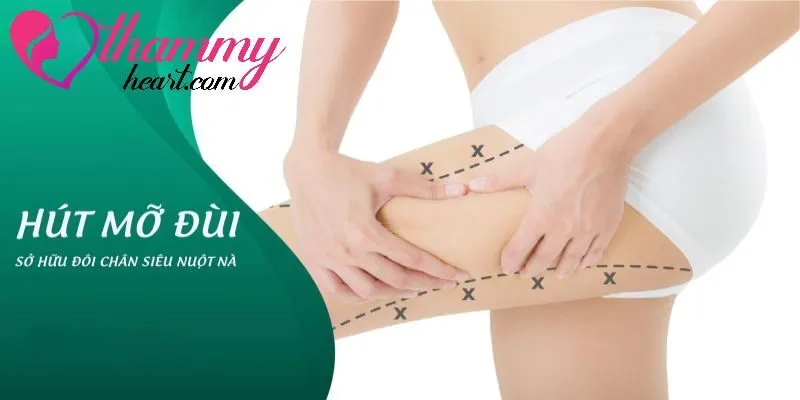 Hút mỡ đùi là nghệ thuật tái tạo đường nét cơ thể giúp đôi chân trở nên thon gọn hơn